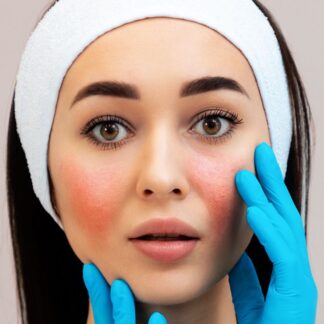 Для чутливої шкіри і при куперозі Redness