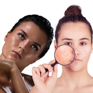 Жирна,комбінована або будь-який тип шкіри з акне ACNE BALANCE